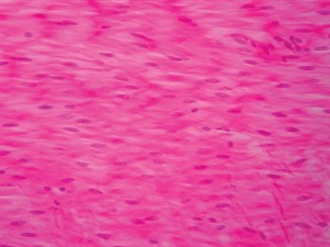 shutterstock_656281006 _cilveka_gludo_muskulu_histologija.jpeg