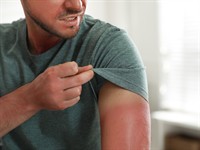 shutterstock_2001116006_Man with sunburned skin_Vīrietis ar saulē apdegušu ādu.jpg