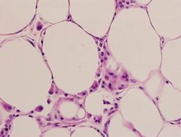 obese_fat_cell_jpg.jpg
