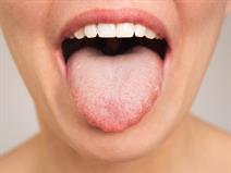 shutterstock_2339161683_tongue_mēle.jpg