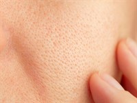 shutterstock_2431197707_skin_āda.jpg
