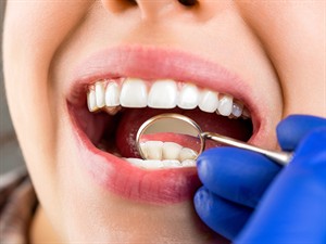 shutterstock_2369254753_teeth examined at dentists_zobuārsts apskata zobus.jpg