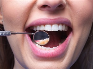 shutterstock_2309567249_dentist mouth mirror_zobuārsta spogulis.jpg
