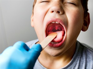 shutterstock_2051026697_tonsils enlarged_palielinātas mandeles.jpg