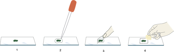 YCUZD_220826_4372_preparāts mikroskopam.png