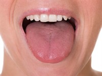 Shutterstock_336266138_tongue_mēle.jpg