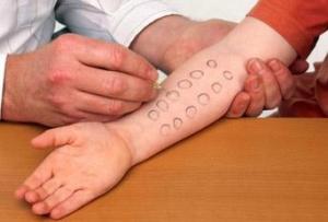 Allergy-Tests.jpg