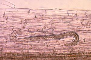 LesionNematode02.jpg