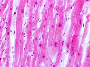Shutterstock_1058497334_cardiac muscle_sirds muskulis.jpg