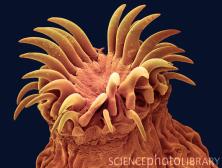 Z1650058-Dog_tapeworm_head,_SEM-SPL.jpg