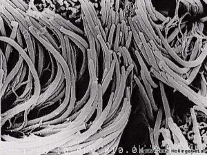ciliated_epithelium.jpg