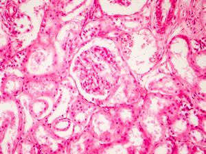 shutterstock_1014960832_Histology of human kidney_Cilvēka nieres histoloģija.jpg