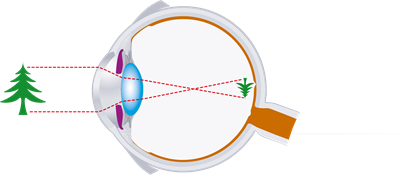 YCUZD_230223_5068_acs_sistēma.png