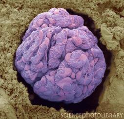 C0074059-Kidney_glomerulus,_SEM-SPL.jpg