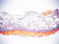 Shutterstock_2478447431_human skin_cilvēka āda.jpg