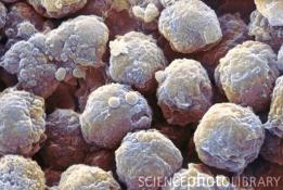P2760173-Neutrophil_white_blood_cells,_SEM-SPL.jpg