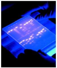 electrophoresis-251x300.jpg
