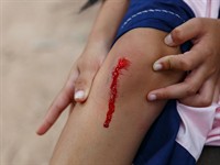 shutterstock_627872426_bleeding wound_asiņojošs ievainojums.jpg