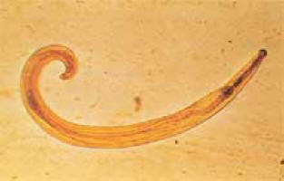 enterobius_vermicularis_r.png