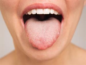 shutterstock_2339161683_tongue_mēle.jpg