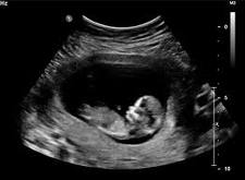 Ultrasonography-Imaging.jpg